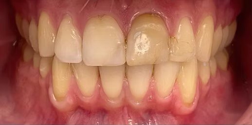 smile-makeover-before-after-10 (1)