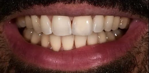 smile-makeover-before-after-3 (4)