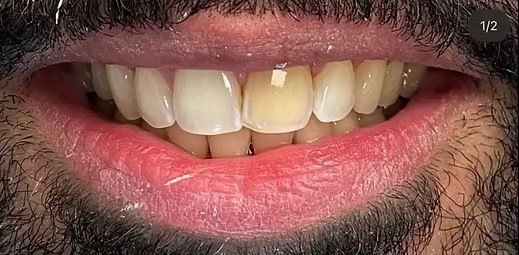 smile-makeover-before-after-3 (5)