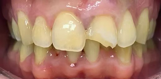 smile-makeover-before-after-5 (1)